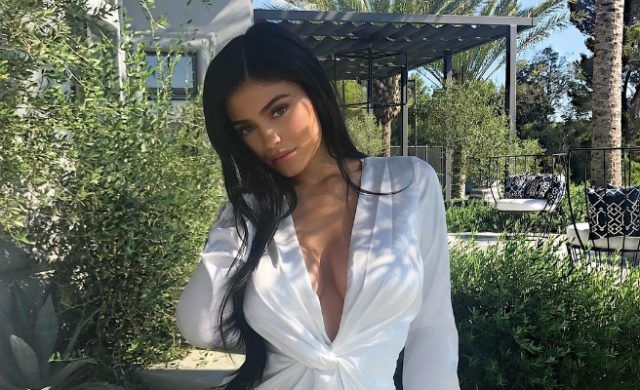 kylie-normal