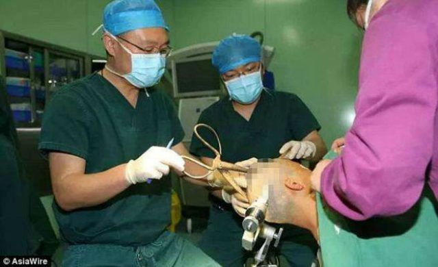 operacion-656