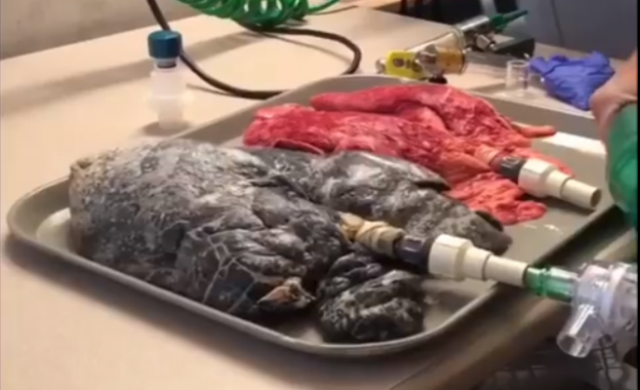 pulmones_656