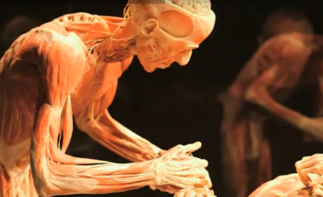 cadaver_656
