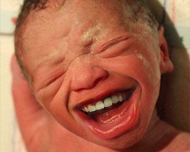 Bebés con dientes de adulto: La ultima moda que arrasa en Internet