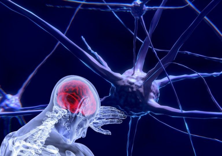 La migraña, una enfermedad invisible que no se puede disimular