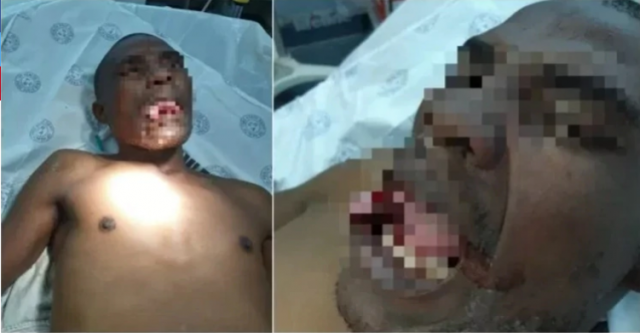 Una Mujer Le Arranca La Lengua A Un Hombre Que Intentó Violarla 1 Curiosas