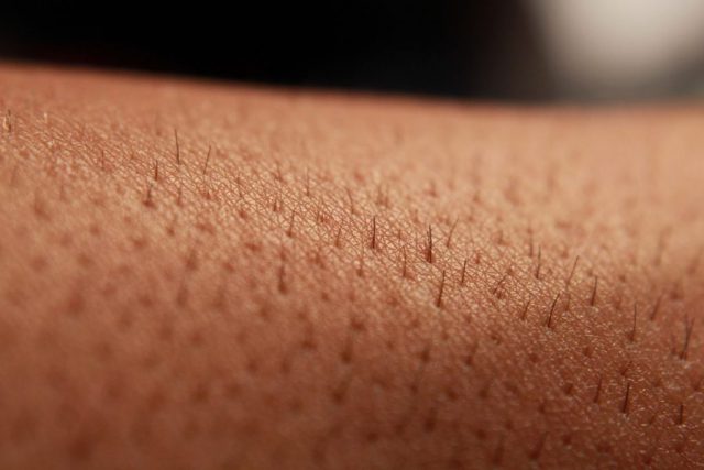 skin-222664_960_720-900x600