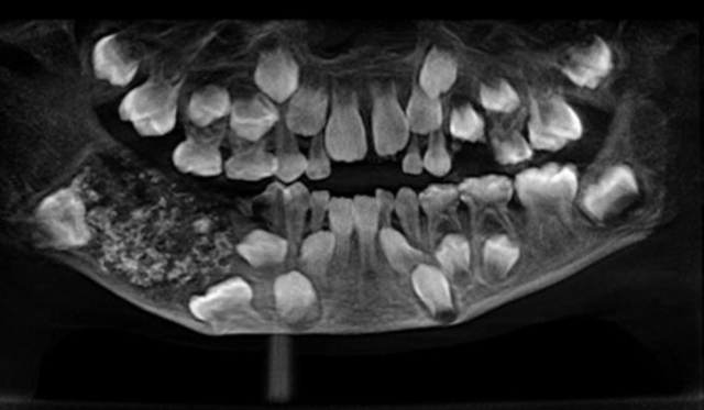 radiografía boca