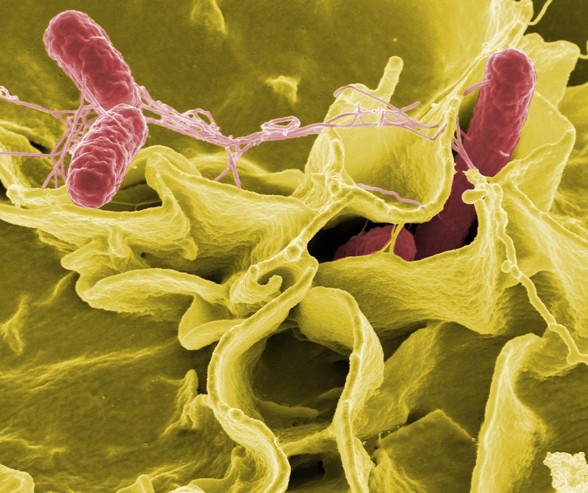 Qué Es La Cistitis 1 Bacteria
