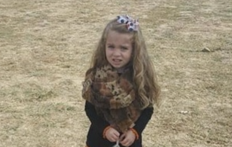 Ilusión óptica: ‘la niña con las piernas de alambre’