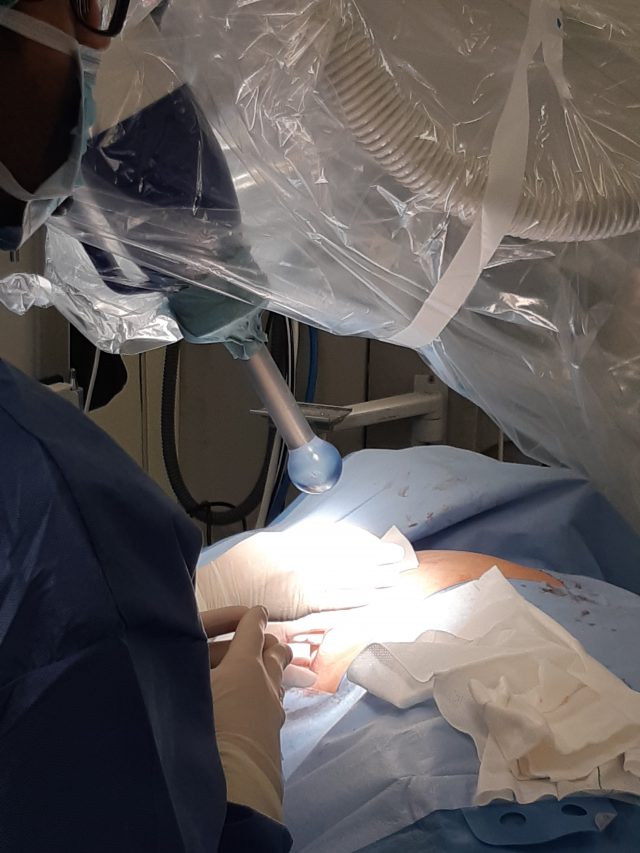 Radioterapia Intraoperatoria Mama Huc