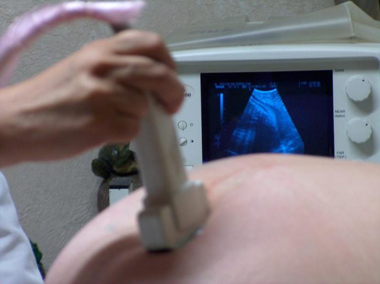 Las embarazadas no transmiten el Covid-19 a los bebés, según un estudio