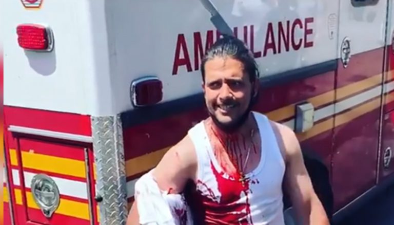 Graban a un hombre con un cuchillo clavado en la cabeza: solo sufrió heridas leves