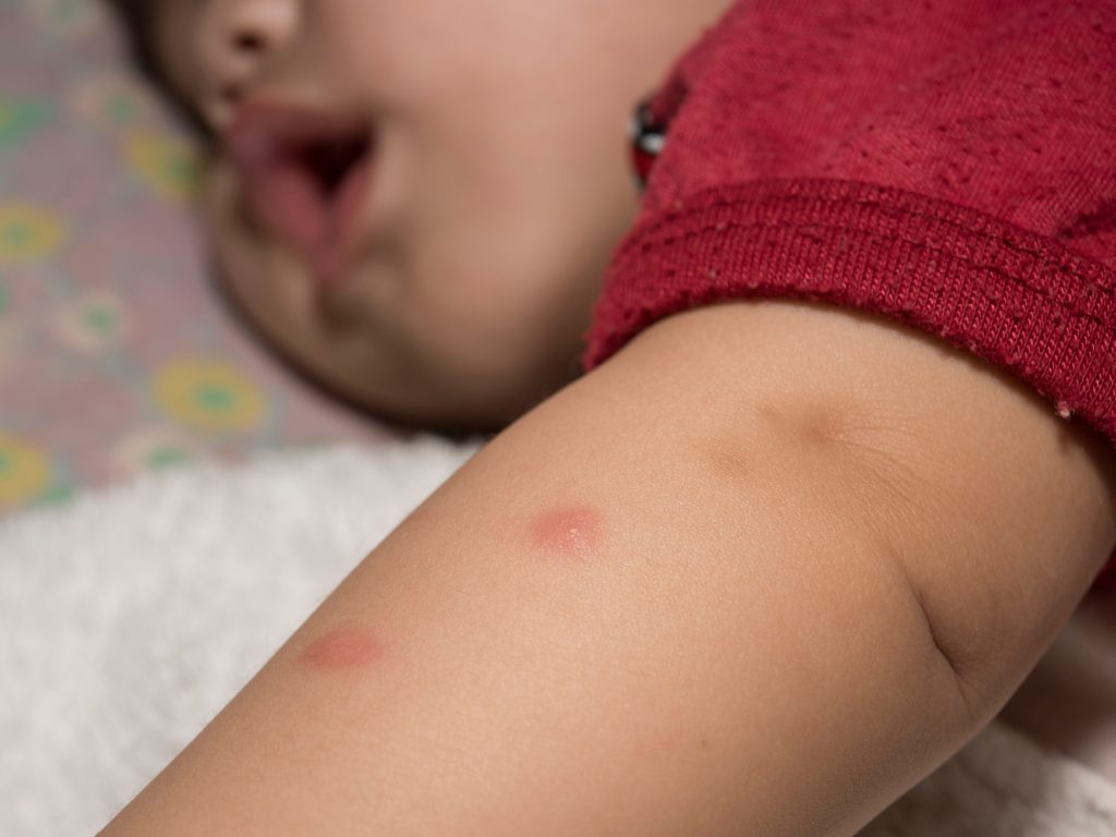 Cómo protegerse de los Mosquitos del Virus del Nilo