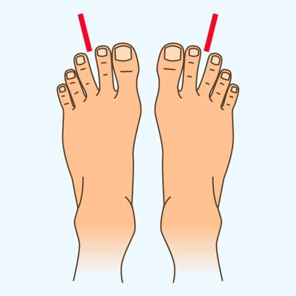 Espacio Entre Los Dedos De Los Pies