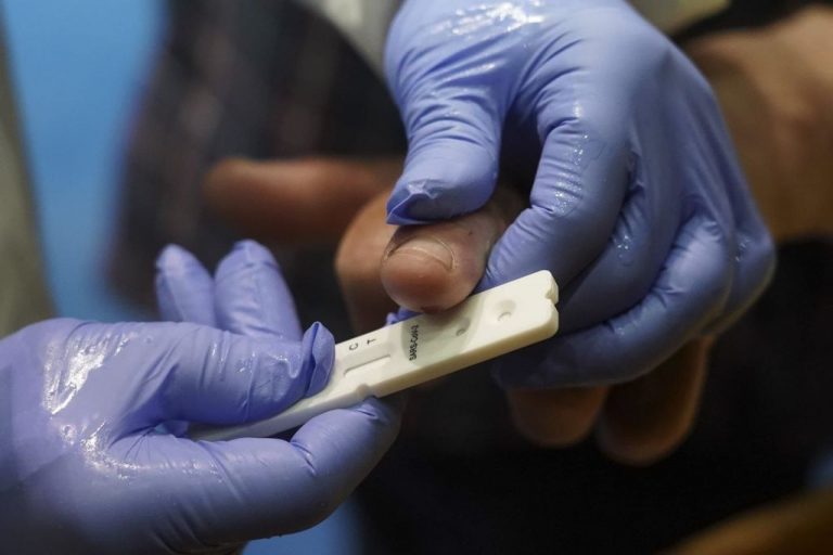 Sanidad aconseja a CCAA tener un ‘stock’ suficiente de pruebas Covid-19