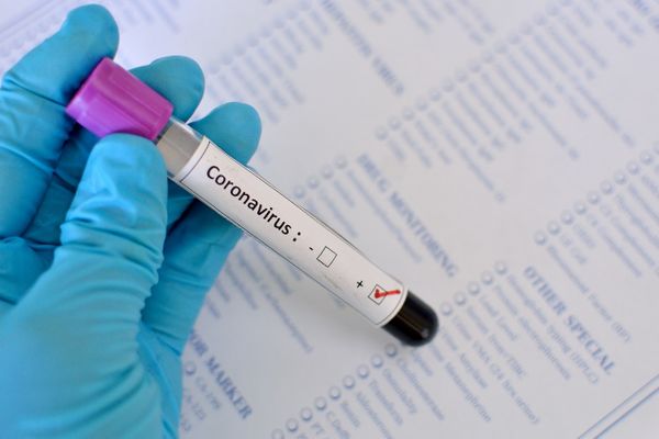 Sanidad notifica 12.788 nuevos casos, 5.986 en 24 horas, y 241 muertes más