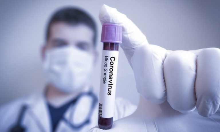 Diseñan sistema de detección precoz del SARS-CoV-2