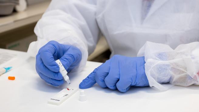 Aragón detecta 713 nuevos casos de COVID-19 y 270 altas epidemiológicas