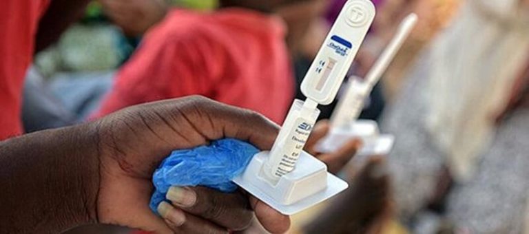 Hasta 136.000 personas fueron diagnosticadas con VIH en Europa en 2019