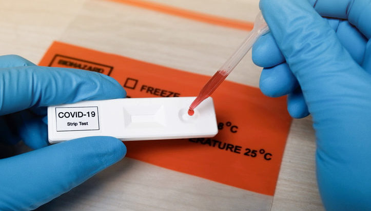 Cataluña apuesta por los test de antígenos para los contactos de positivos