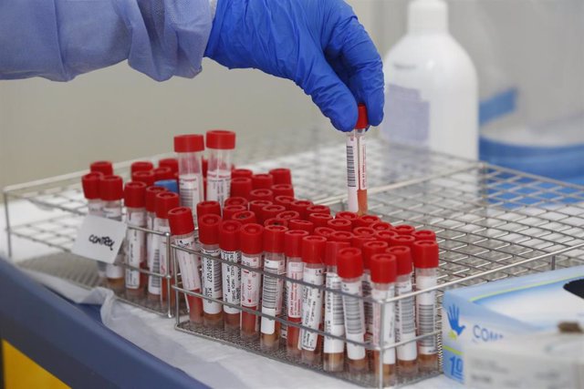Positivos en los centros gallegos descienden hasta los 1.263