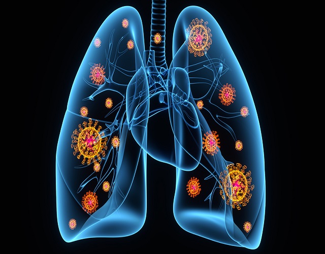 Covid-19 pulmones