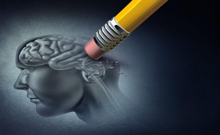 Identifican cambios cerebrales 20 años antes de diagnosticar Alzheimer