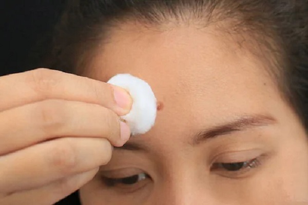 Cejas Y Frente