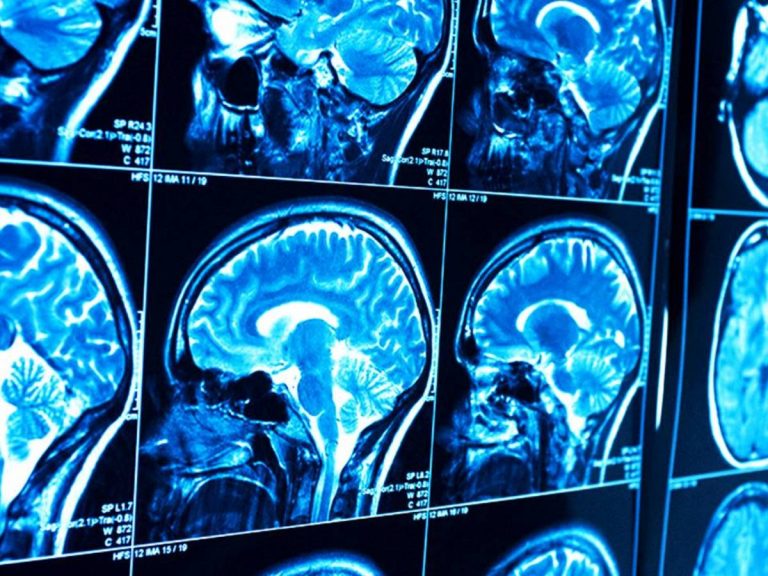 Así son las nanopartículas que transportan fármacos por tu cerebro