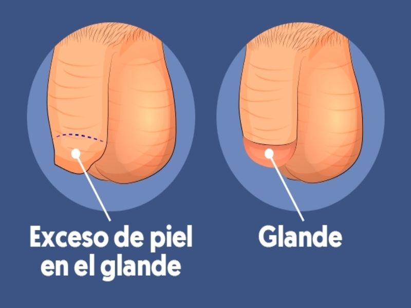 Como Prevenir Esta Enfermedad