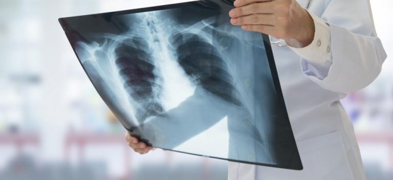 Pacientes con EPOC denuncian el «abandono» que sufren por parte del Gobierno