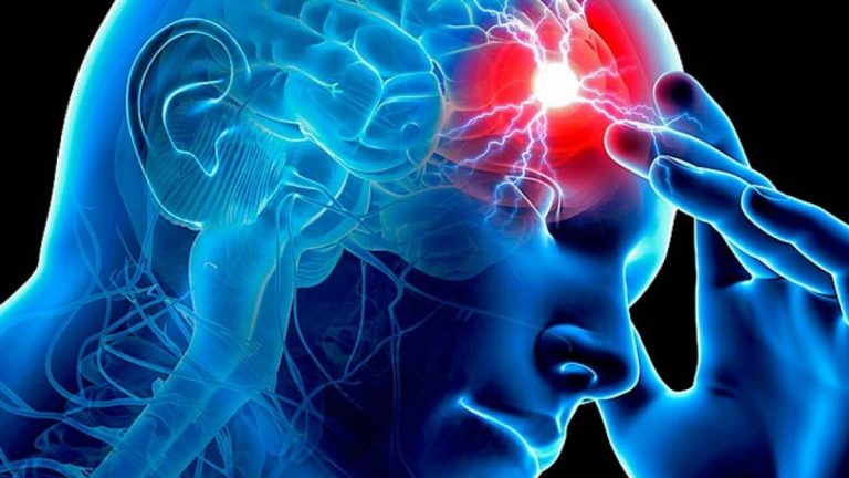¡Está en peligro! Las señales que te avisan de que una persona sufre un ictus