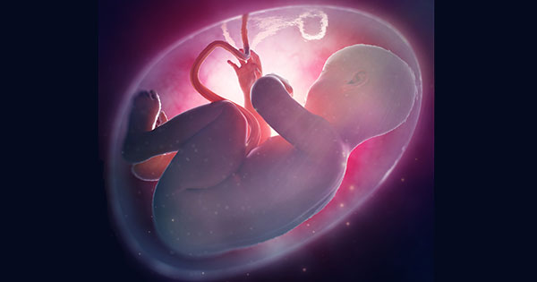 Desprendimiento De Placenta: 