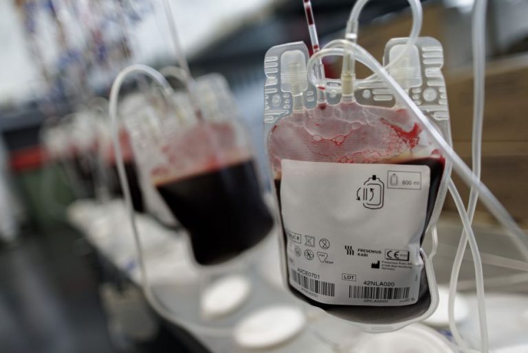 Mucha azúcar en sangre aumentaría la mortalidad en pacientes Covid no diabéticos