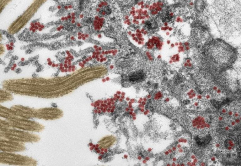 Un estudio muestra que la Covid-19 llega al cerebro a través de la nariz