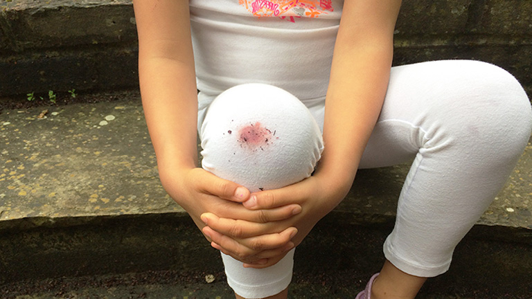 patrocinado vamos a hacerlo anillo Cómo quitar las manchas de sangre de la ropa usando métodos caseros