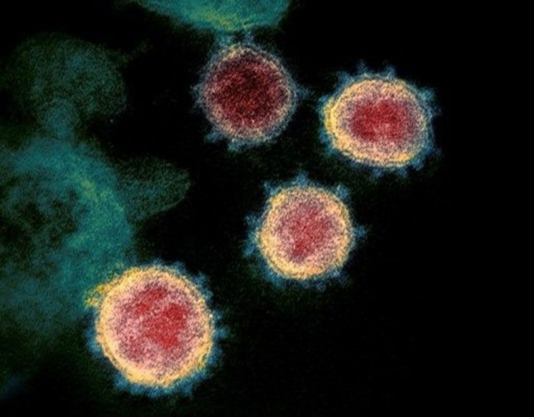 La Fundación ”la Caixa” abre una convocatoria para proyectos de innovación vinculados al coronavirus