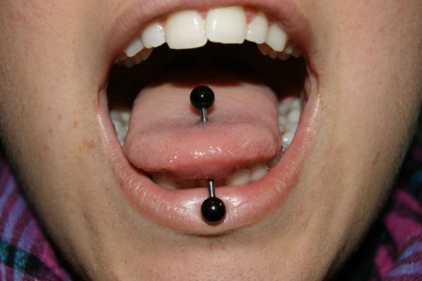 La lengua y sus ramificaciones arteriales