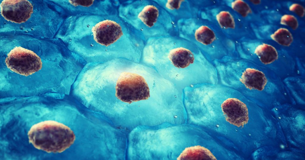 Células normales o cancerosas
