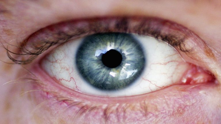 Qué es el mal de ojo