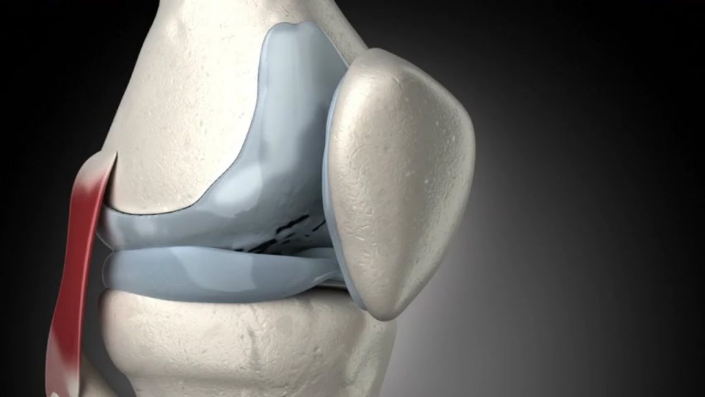 Biomecánica Meniscal