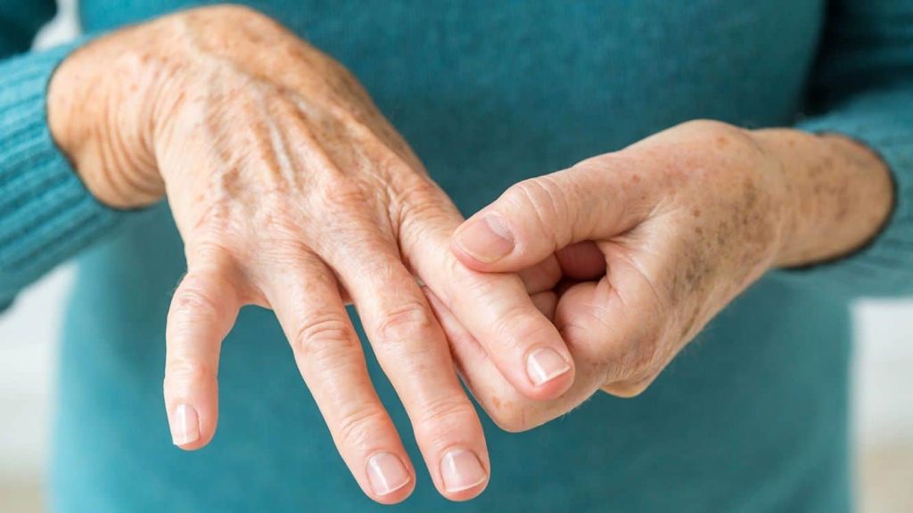 Síntomas de la artritis