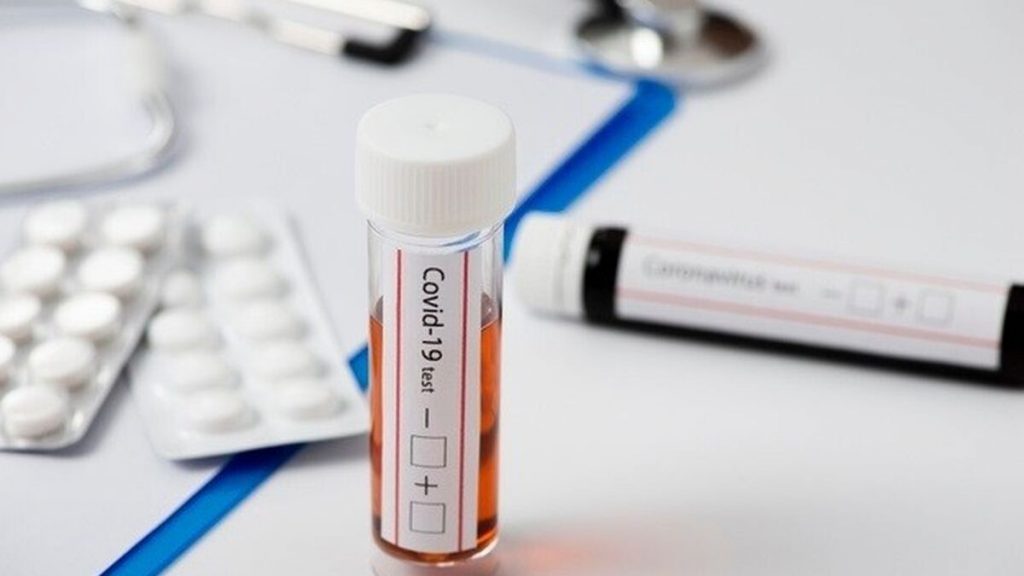 ¿Qué Es El Test De Antígenos?