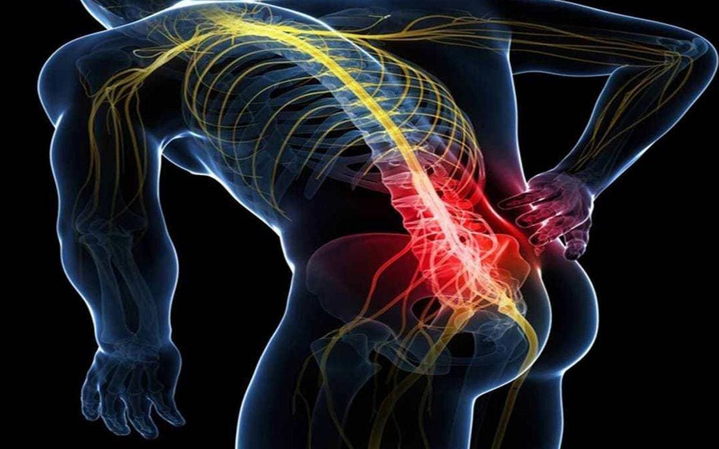 Ciática: Así Te Avisa Tu Cuerpo De Que Algo Va Mal 1 ¿Pero Qué Es Exactamente La Ciática?
