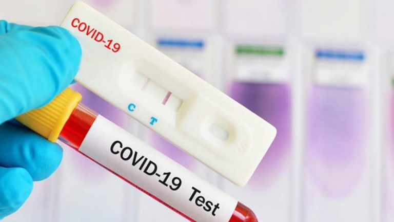 Asturias registra 18 fallecimientos en una jornada con 222 nuevos contagios