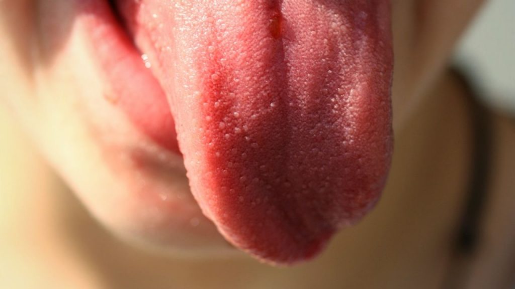 Lengua Rojo