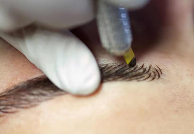 Ventajas Del Microblading