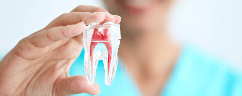 Preguntas Frecuentes De La Endodoncia 