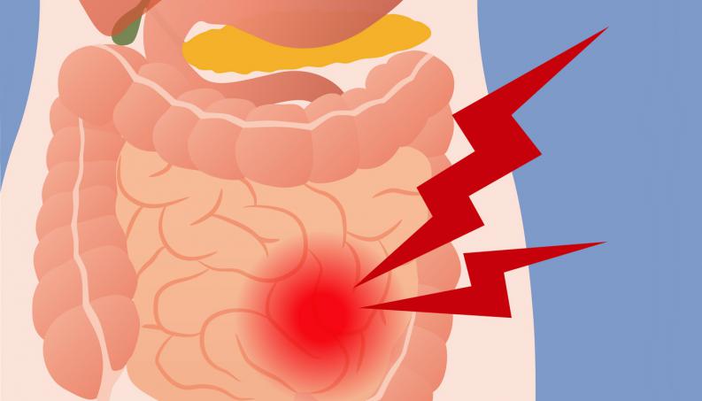 Dolor De Intestinos