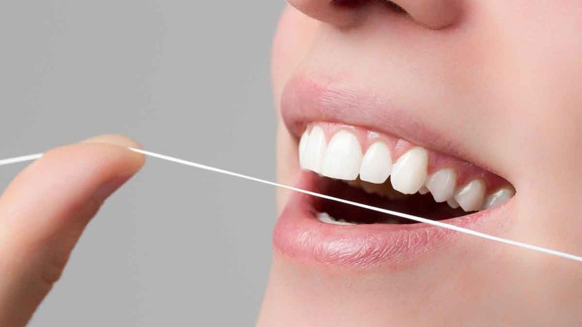 El Cuidado De Los Implantes Dentales Se Centra En La Higiene