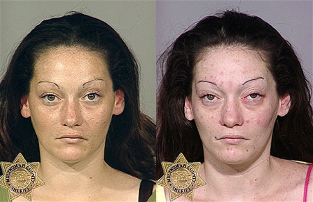 El antes y después de la gente que tomó muchas drogas 2