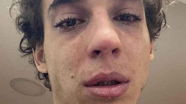 Las Veces Que Miguel Herrán Ha 'Desnudado' Sus Penas A Través De Instagram